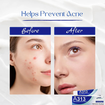 A313 Vitamin A Retinol Cream - 200 UI Pommade